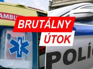 BRUTÁLNY ÚTOK POLICAJTA Muža surovo mlátil do hlavy, skončil dolámaný! Šok, čo všetko mu spravil